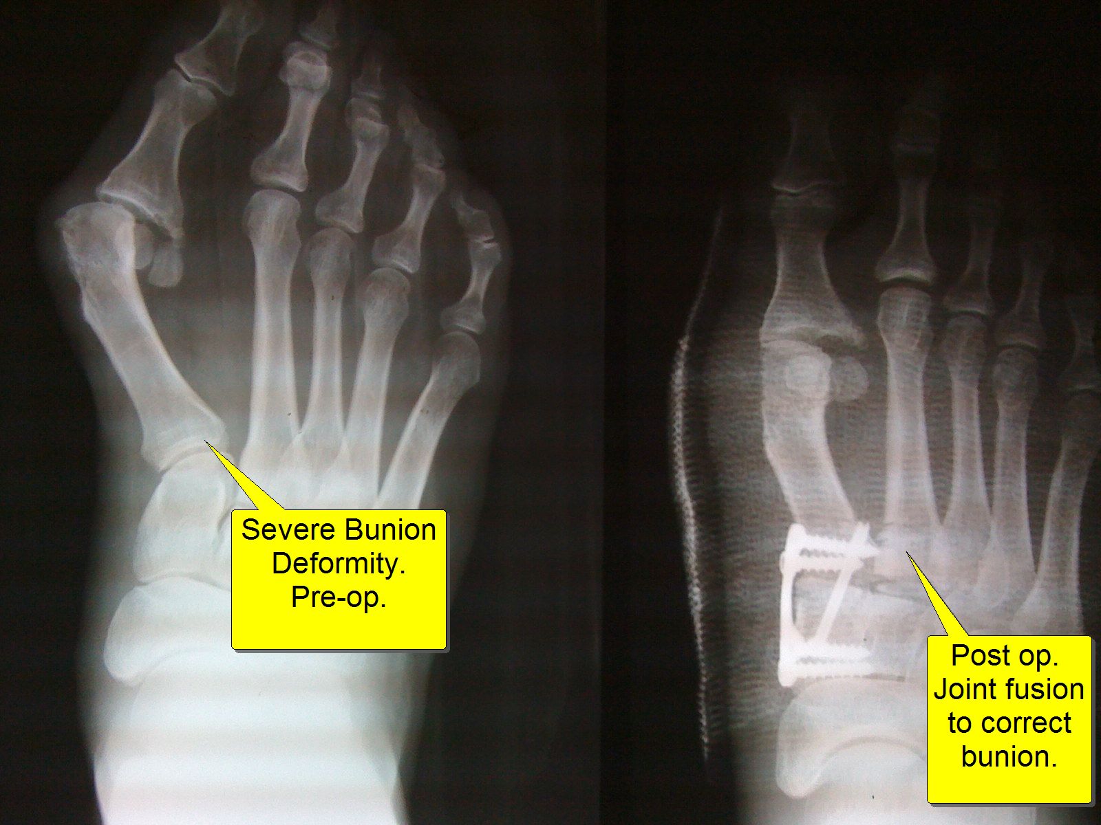 X-Ray Before & After