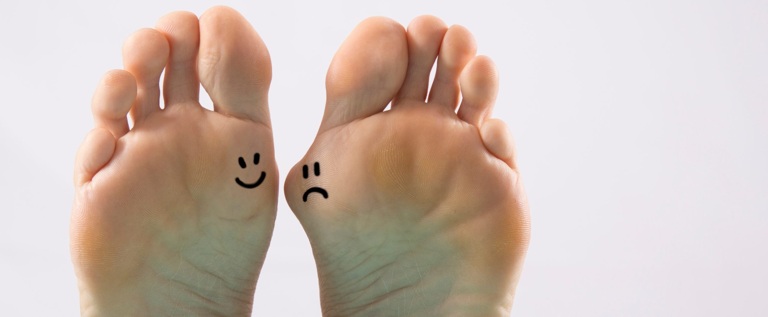 Bunion Surgeon in Midtown NY Bunion Surgeon in Midtown NY