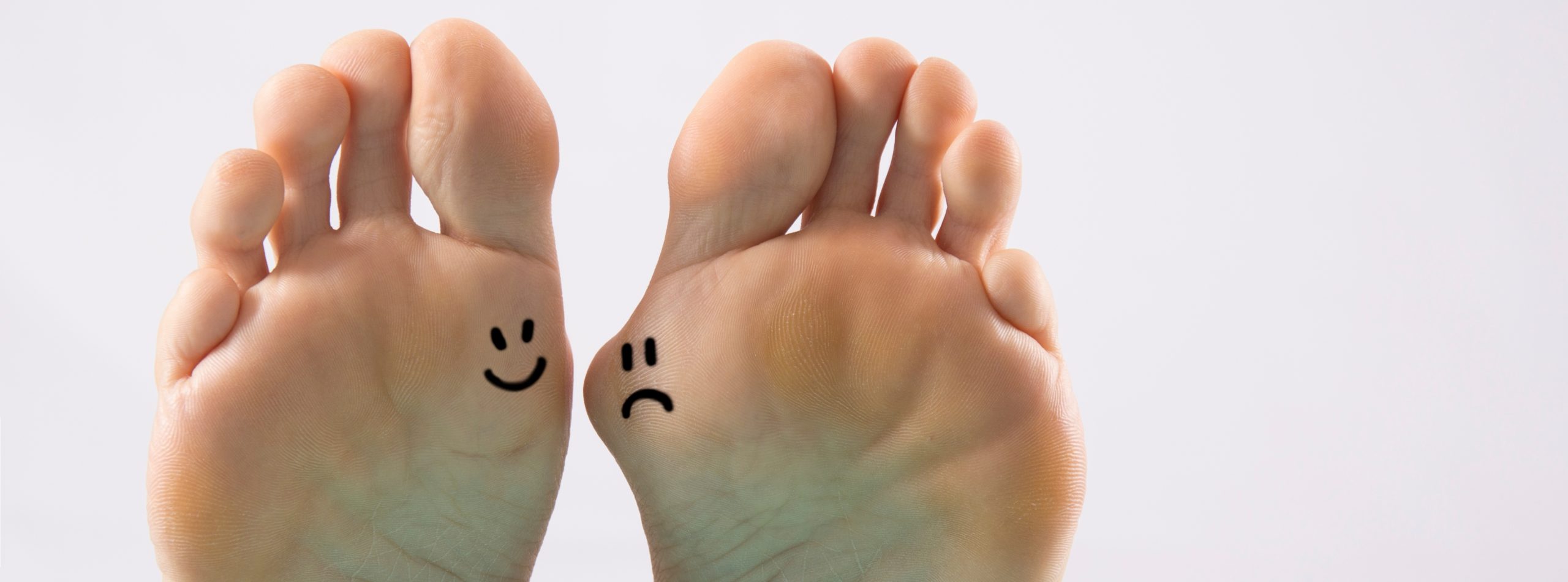 Bunion Surgeon in Chelsea NYC