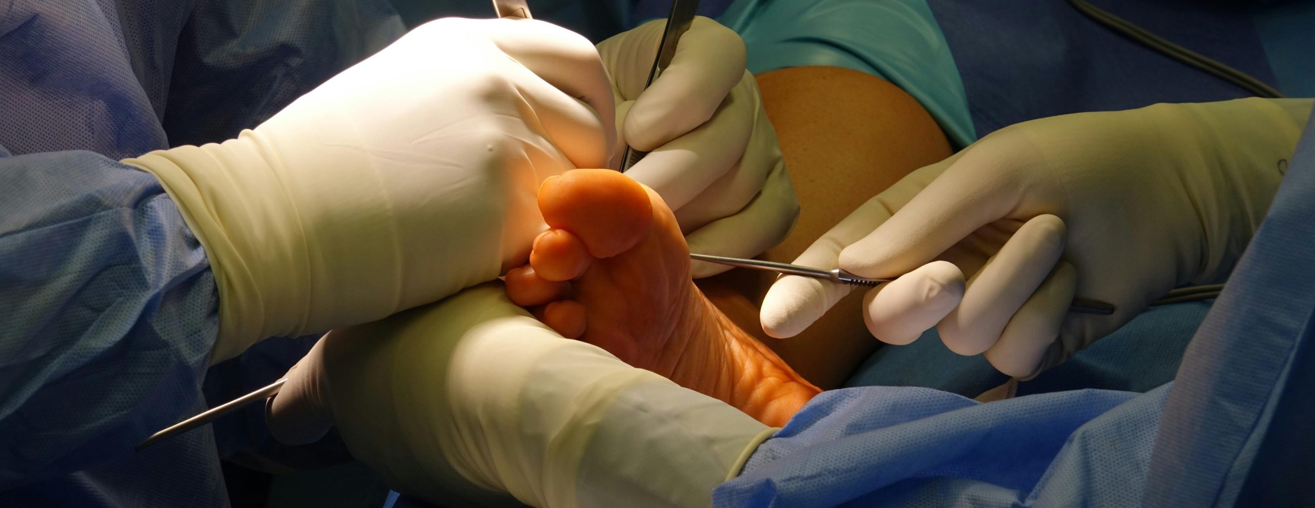 Bunion Surgeon in Hell’s Kitchen