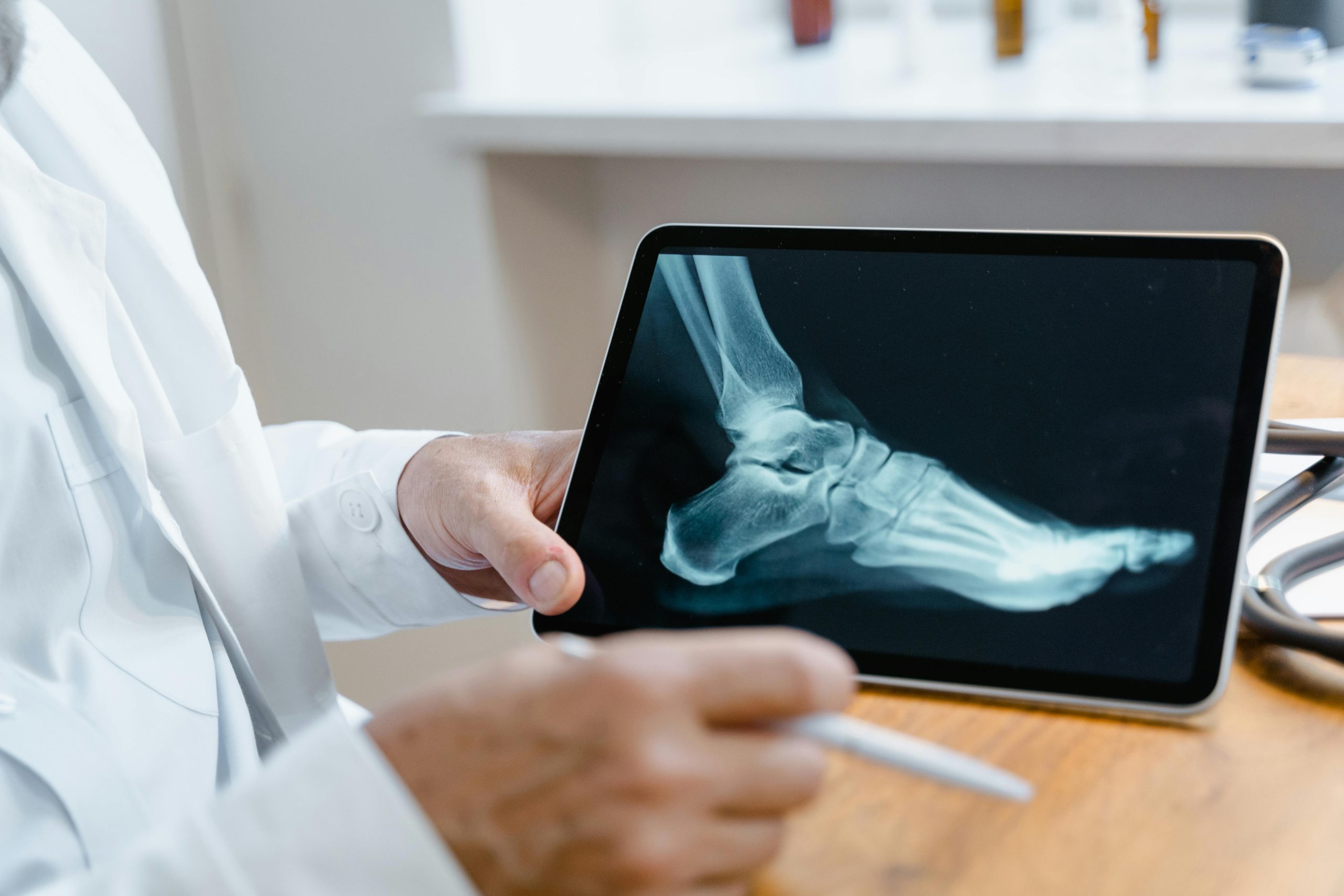 Bunion Surgery in Hell’s Kitchen NYC