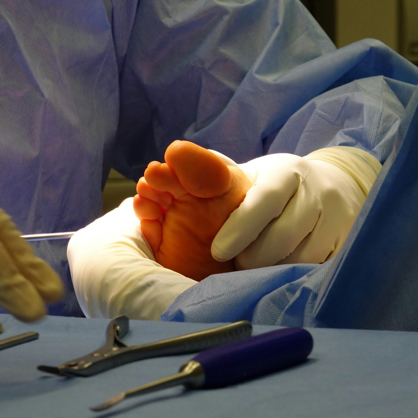 hammertoe correction Manhattan Valley NYC