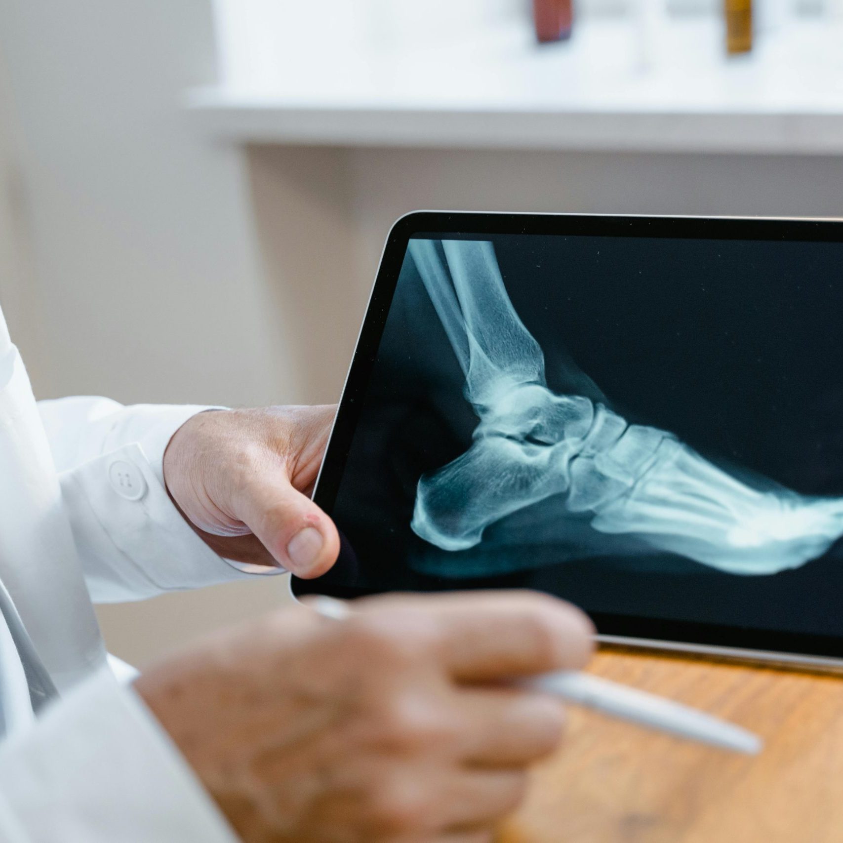 Bunion treatment Gramercy Bunion treatment Gramercy